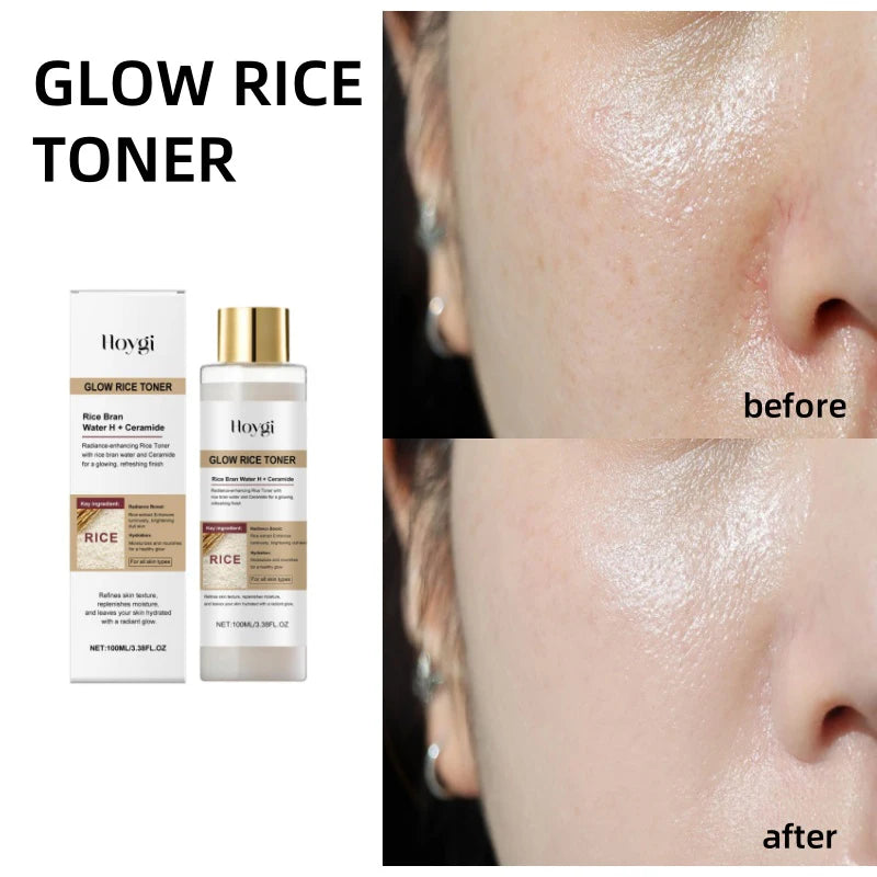 Radiant Rice Essence Ampule Set™